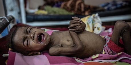 UAE: Stop famine in Sudan